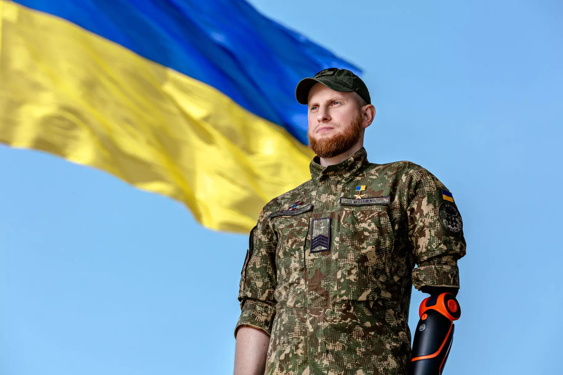 Протезування для військових